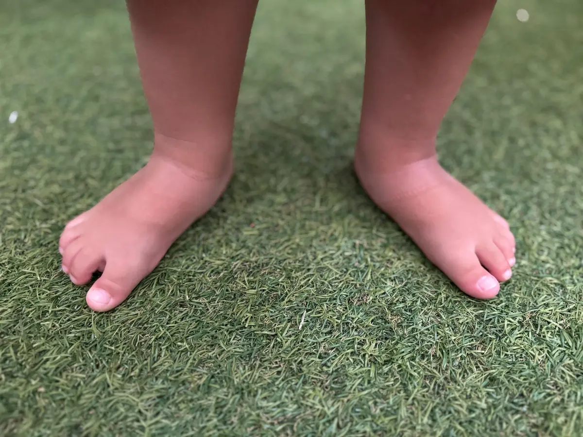Podología infantil Terrassa